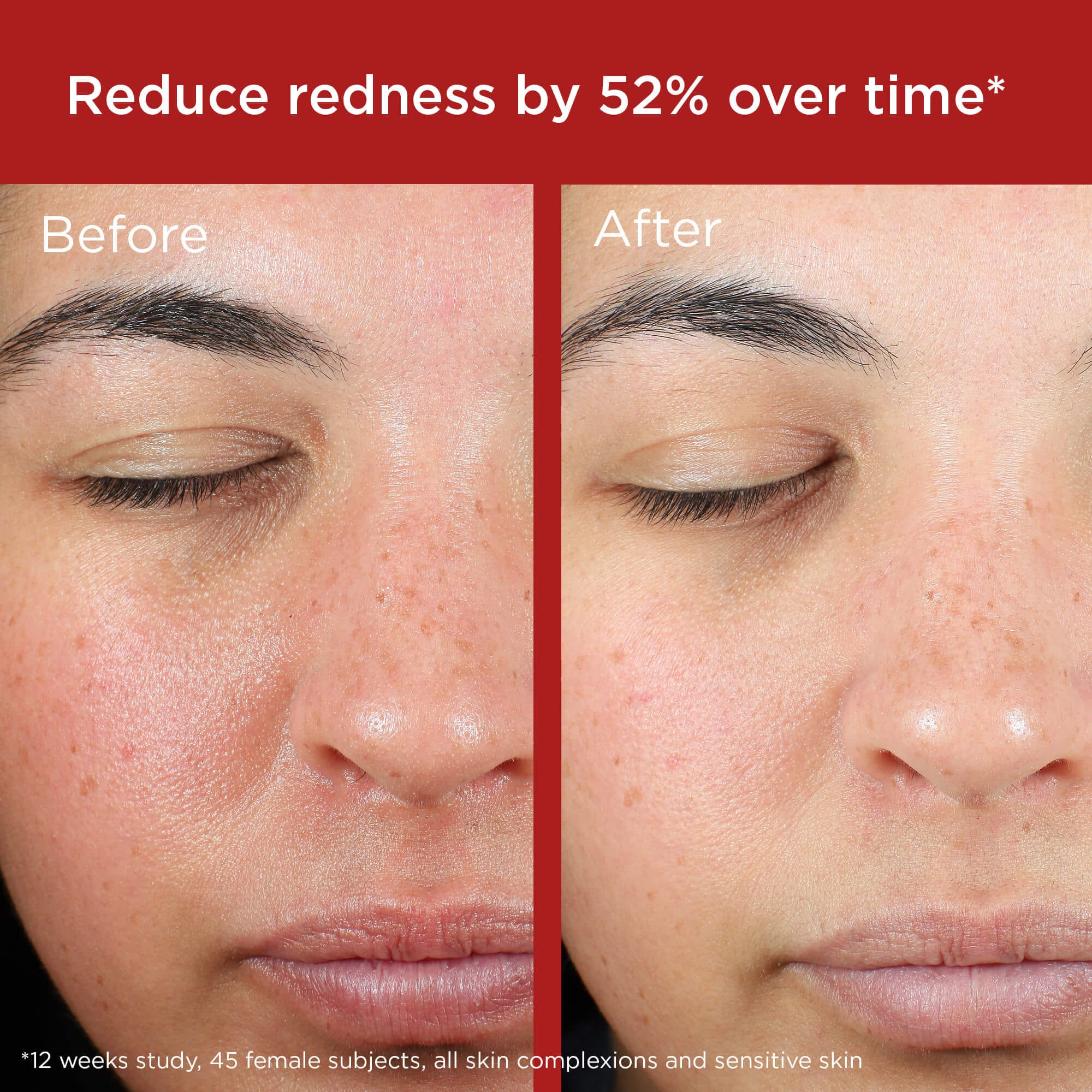 EltaMD UV Skin Recovery Broad Spectrum SPF 50 Face Sunscreen