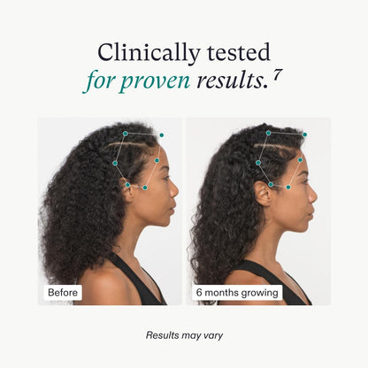 Nutrafol Women's Vegan Hair Growth Nutraceutical