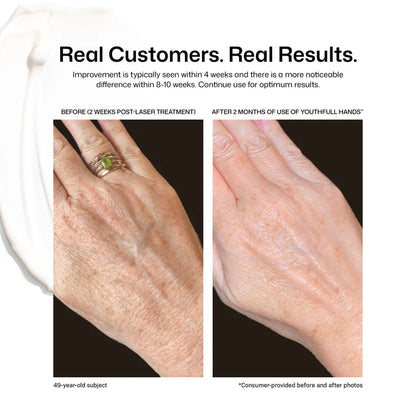 Revision Skincare YouthFull Hands