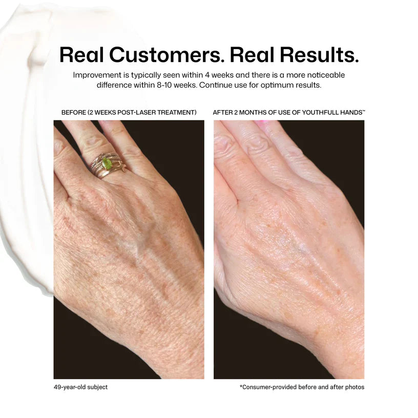 Revision Skincare YouthFull Hands