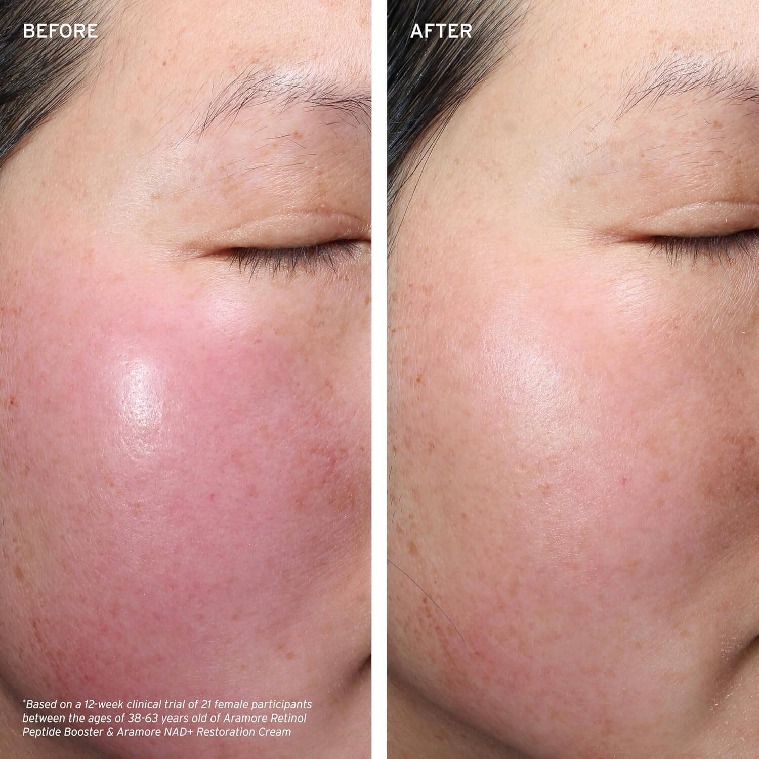 Aramore Retinol Peptide Boosting Serum