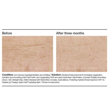PCA Skin ExLinea® Peptide Smoothing Serum