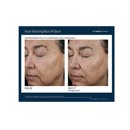 Skinbetter® Better  Ampra Volumizing Macro HA Serum - 1 fl. oz. / 30ml