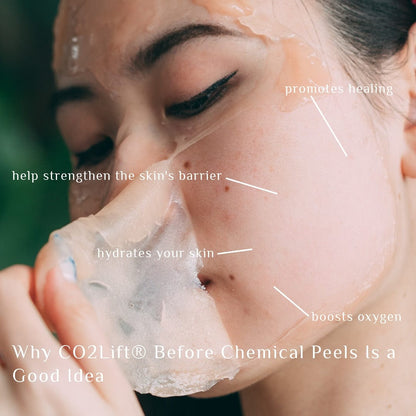 CO2Lift PRO Carboxy Gel Treatment