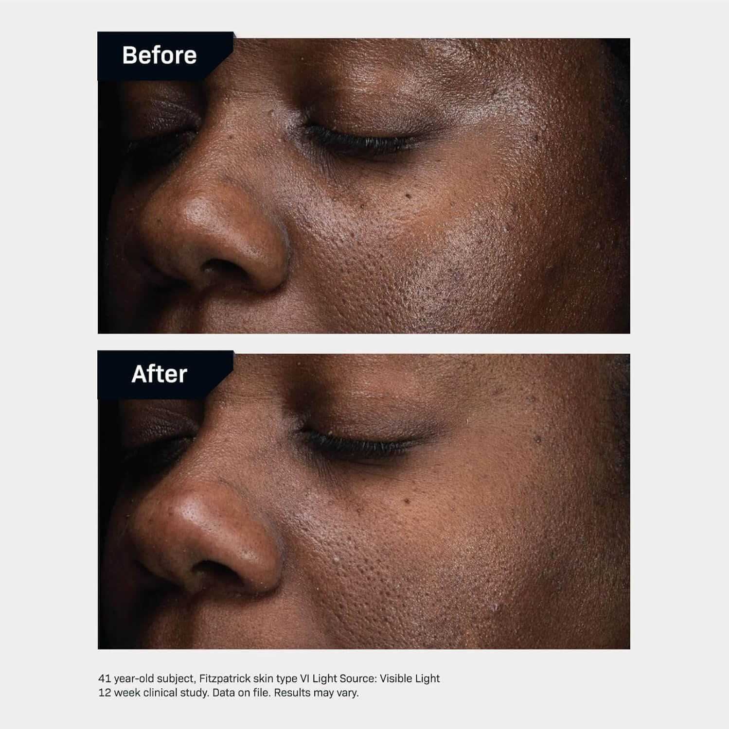 Revision Skincare D.E.J Daily Boosting Serum