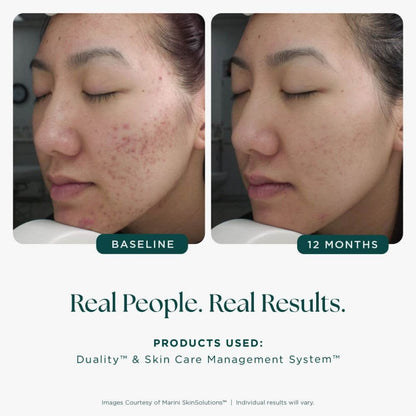 Marini Skin Solutions Duality Acne Treatment Cream