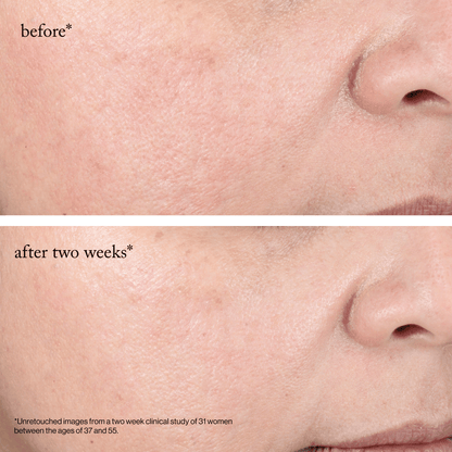 goop beauty 15% Glycolic Acid Overnight Glow Peel