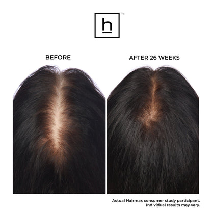 Hairmax Laser Band 41 ComfortFlex Hair Growth Device