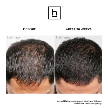 Hairmax Laser Band 82 Comfort Flex Hair Growth Device