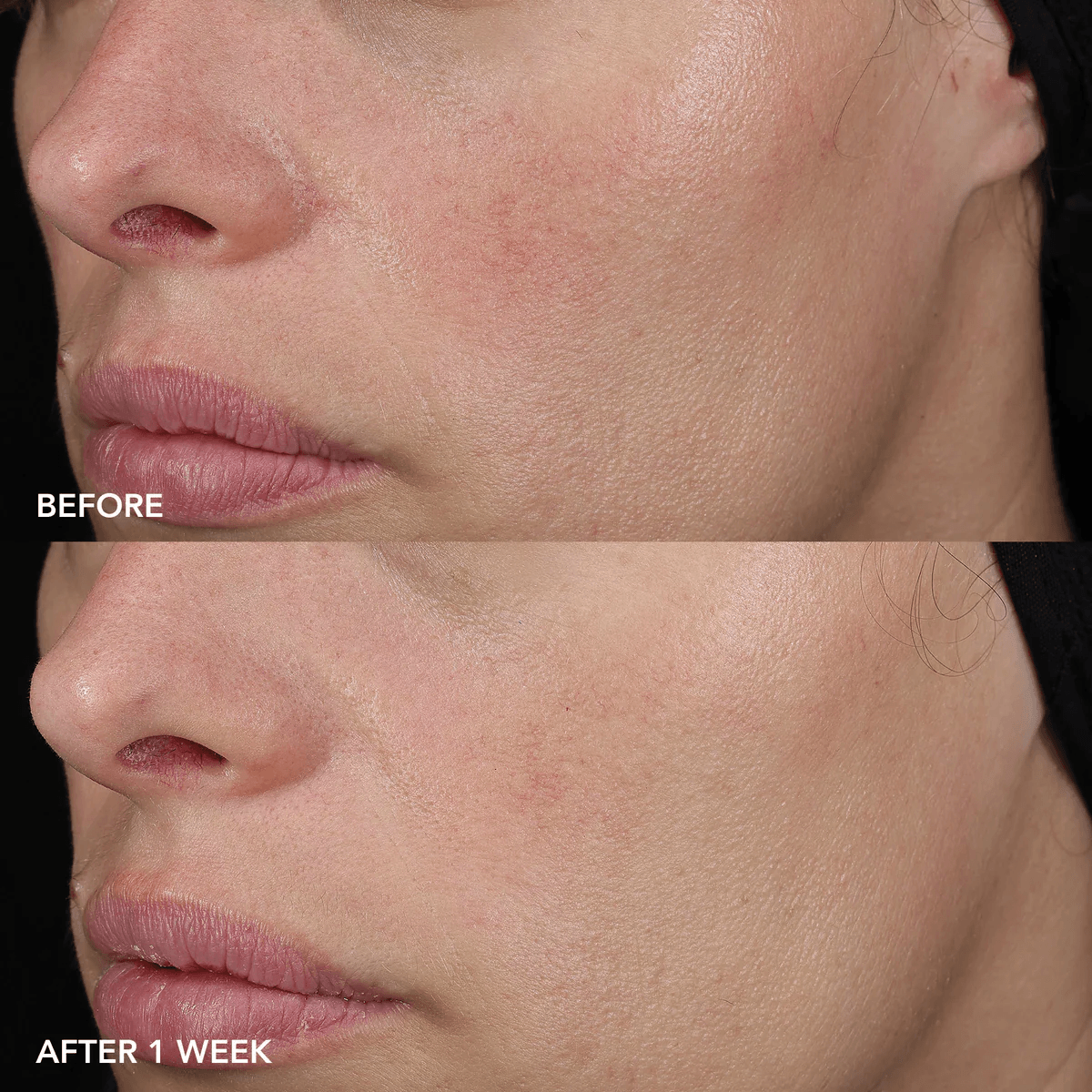IMAGE Skincare IMAGE MD Barrier Repair Recovery Balm