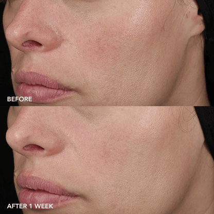 IMAGE Skincare IMAGE MD Barrier Repair Recovery Balm