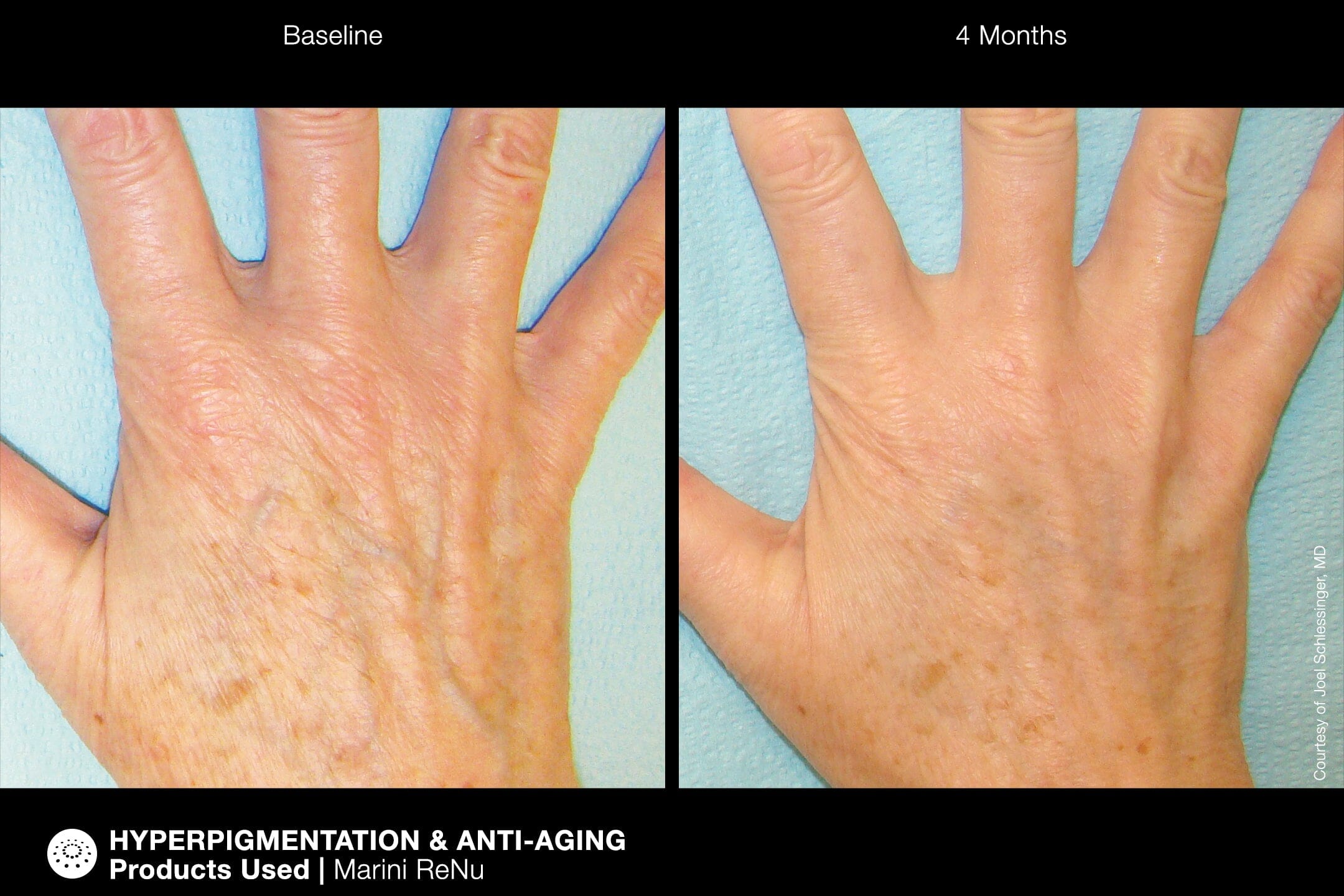 Jan Marini ReNu Corrective Hand Complex