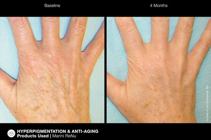Jan Marini ReNu Corrective Hand Complex