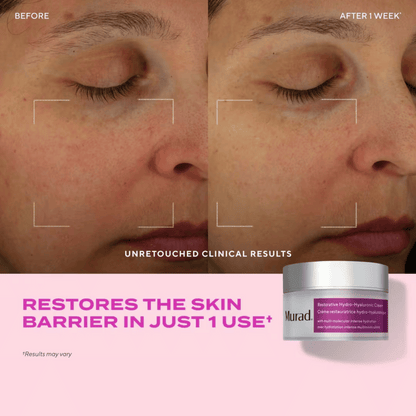Murad Restorative Hydro-Hyaluronic Moisture Cream