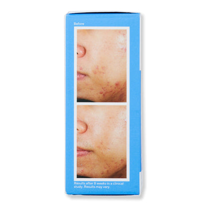 Murad Deep Relief Acne Treatment
