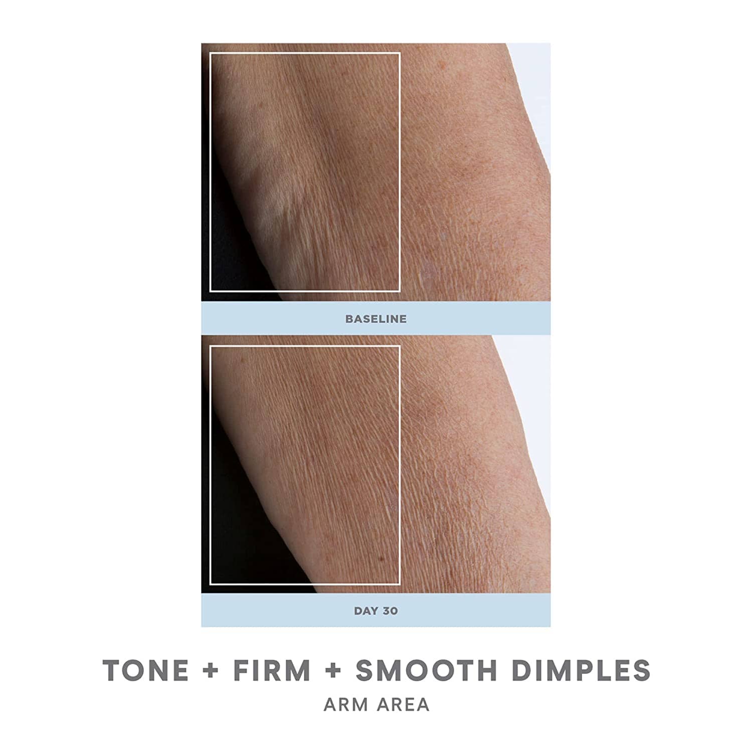 NuFACE NuBODY Toning and Firming Kit