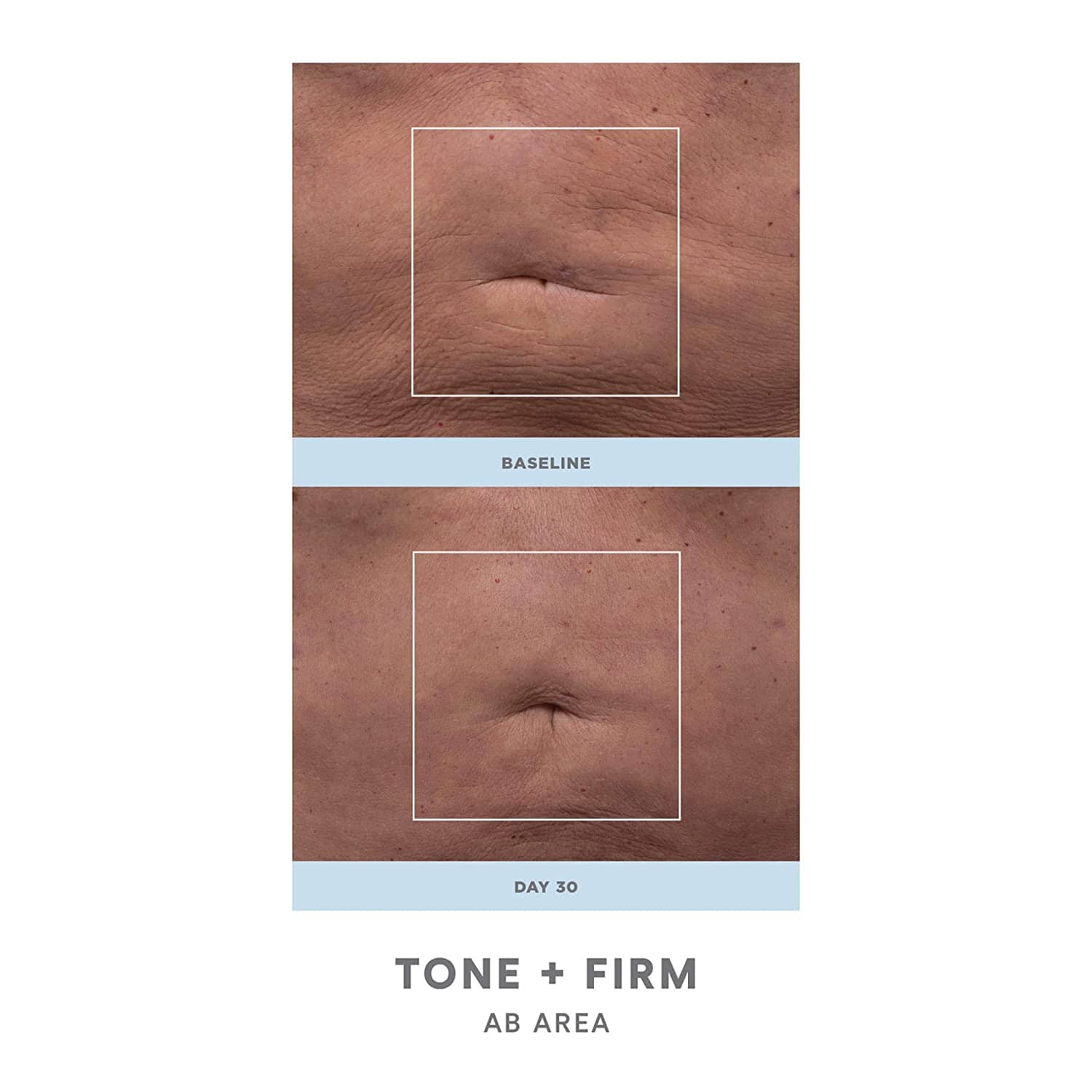 NuFACE NuBODY Toning and Firming Kit