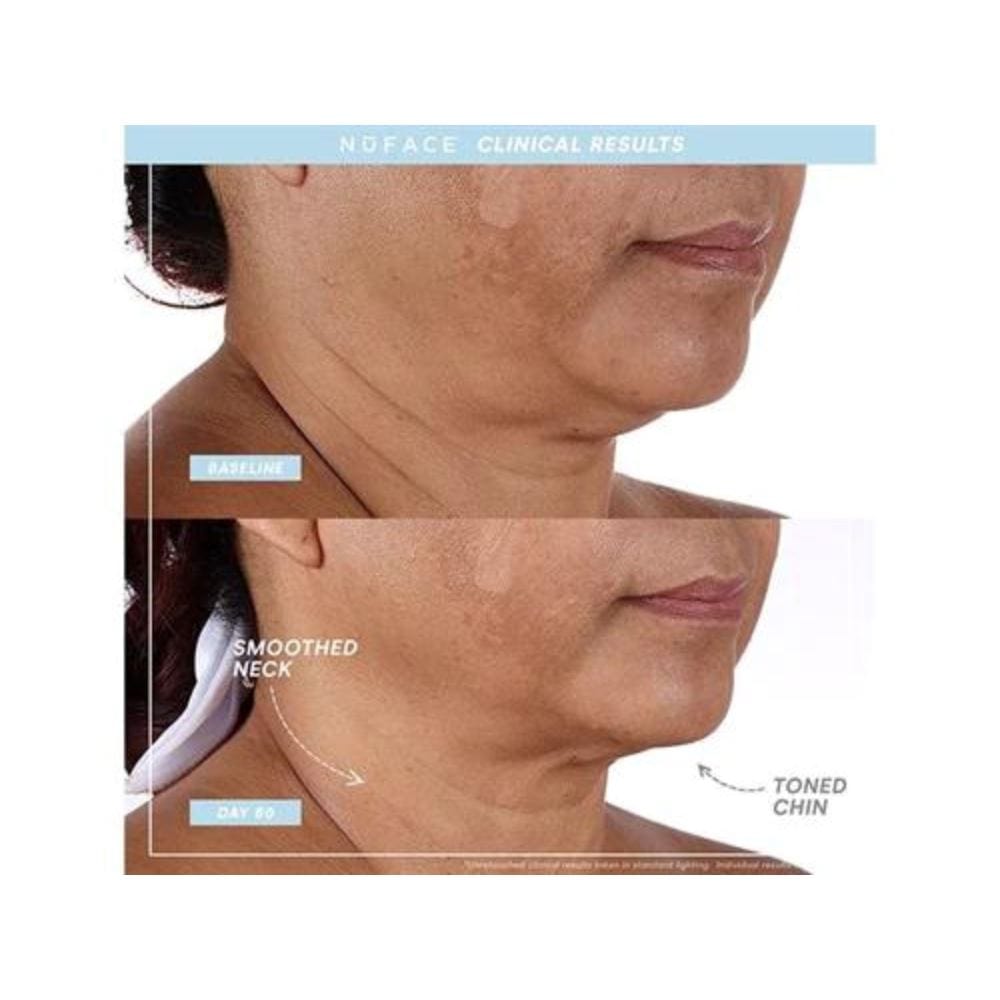 NuFACE TRINITY+ PRO Starter Kit