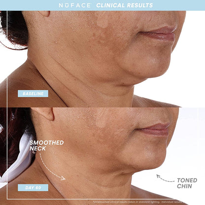 NuFACE TRINITY+ Facial Toning Starter Kit