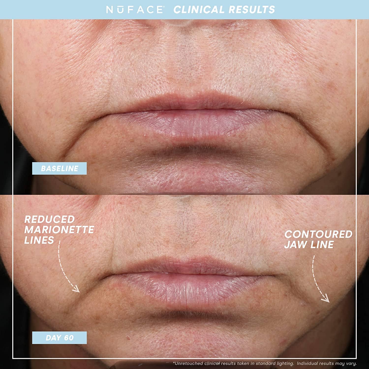NuFACE TRINITY+ Facial Toning Starter Kit