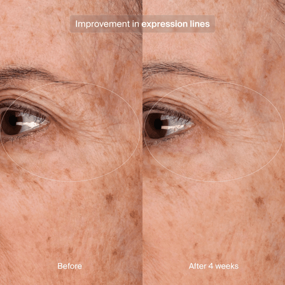 Pavise Precision Eye Lift