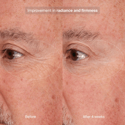 Pavise Precision Eye Lift