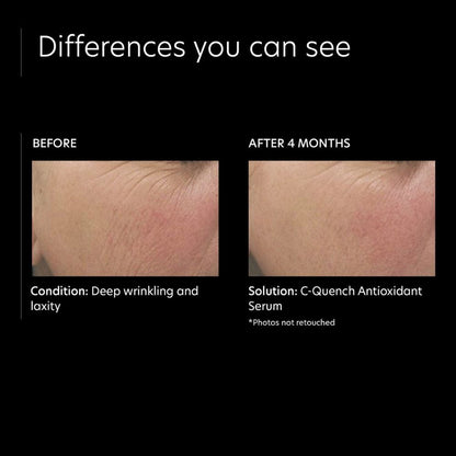 PCA Skin C-Quench Antioxidant Serum