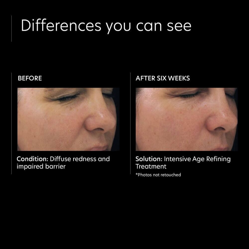 PCA Skin Intensive Age Refining Treatment: 0.5% pure retinol night