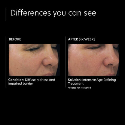 PCA Skin Intensive Age Refining Treatment: 0.5% pure retinol night