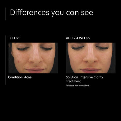PCA Skin Intensive Clarity Treatment: 0.5% Pure Retinol Night