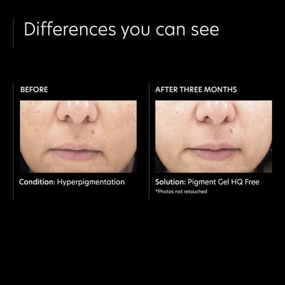 PCA Skin Pigment Gel HQ Free