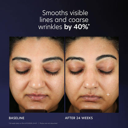 PCA Skin Pro-Max Age Renewal Advanced Anti-aging Serum