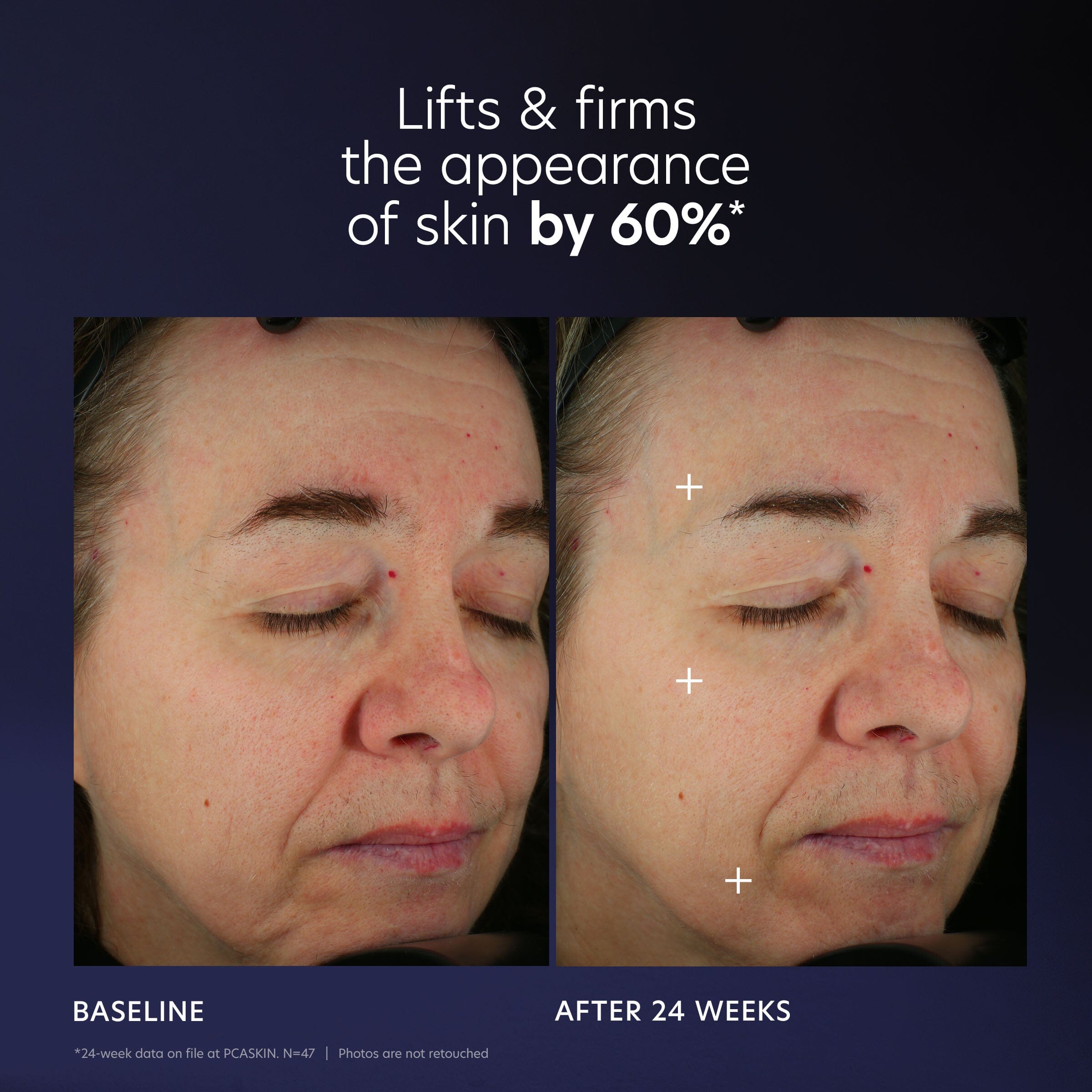 PCA Skin Pro-Max Age Renewal Advanced Anti-aging Serum