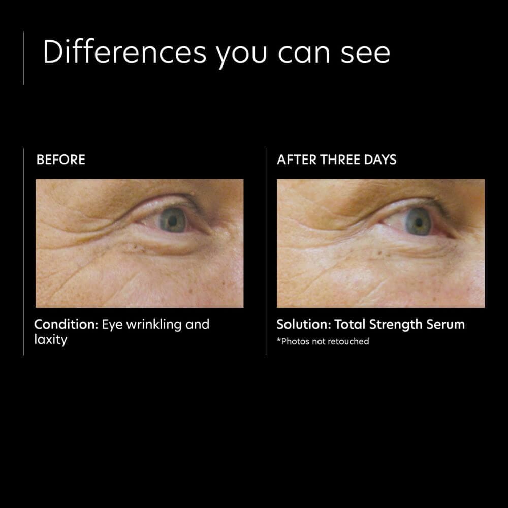 PCA Skin Total Strength Serum