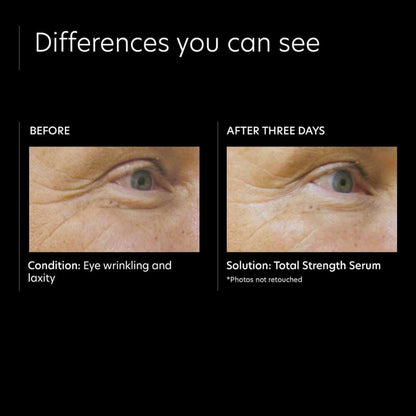PCA Skin Total Strength Serum