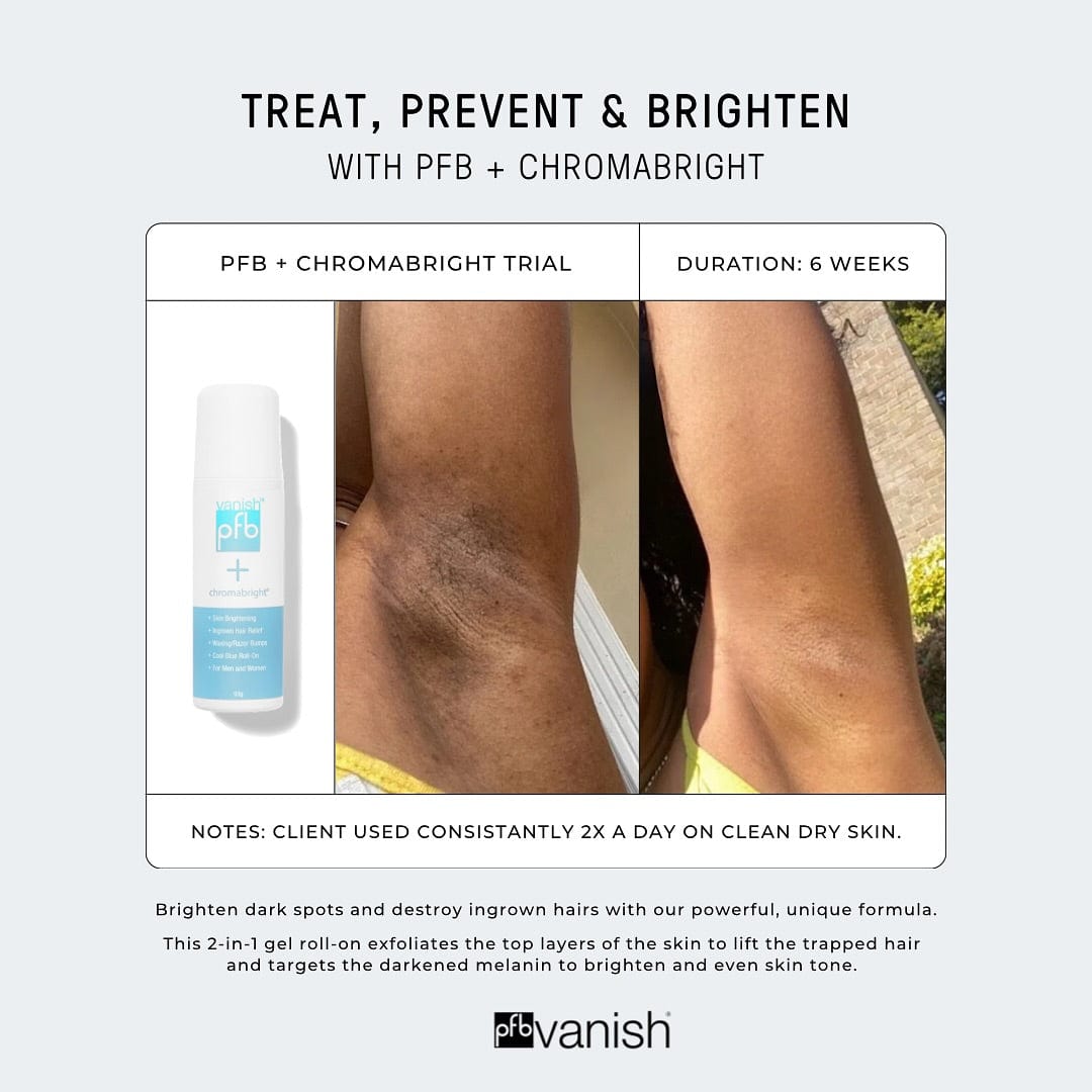 PFB Vanish + Chromabright Skin Lightener & Bump Fighter