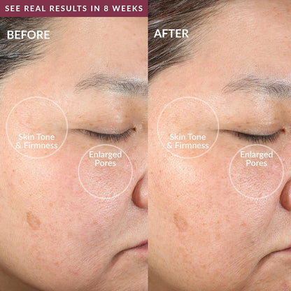 PMD Clean Smart Facial Cleansing Device