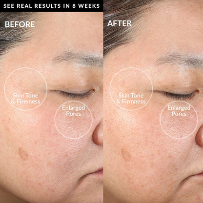 PMD Clean Smart Facial Cleansing Device