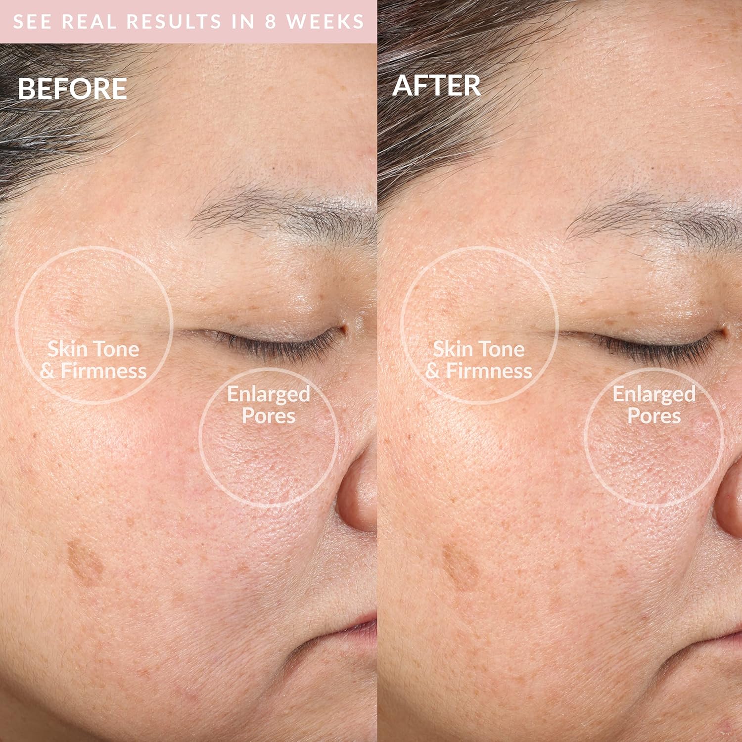 PMD Clean Smart Facial Cleansing Device