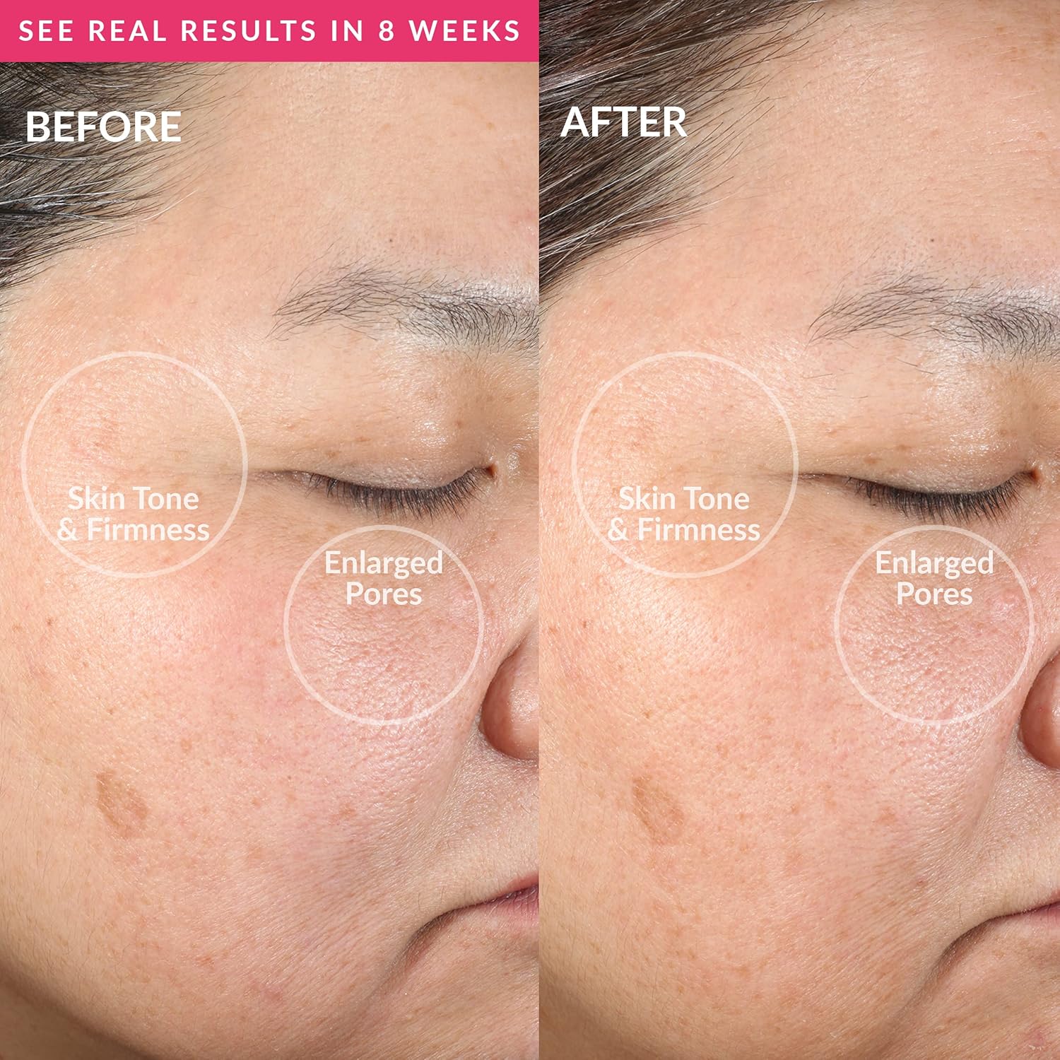 PMD Clean Smart Facial Cleansing Device