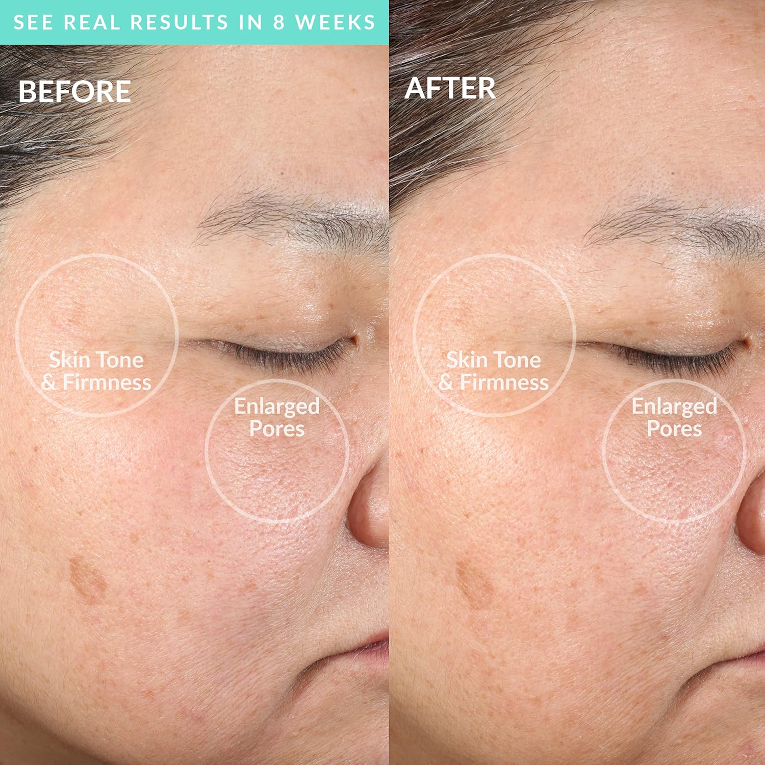 PMD Clean Smart Facial Cleansing Device