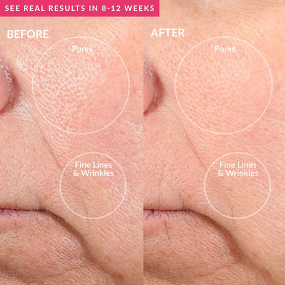 PMD Personal Microderm Pro