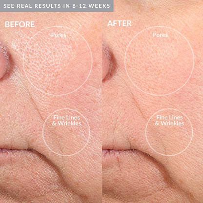 PMD Personal Microderm Pro