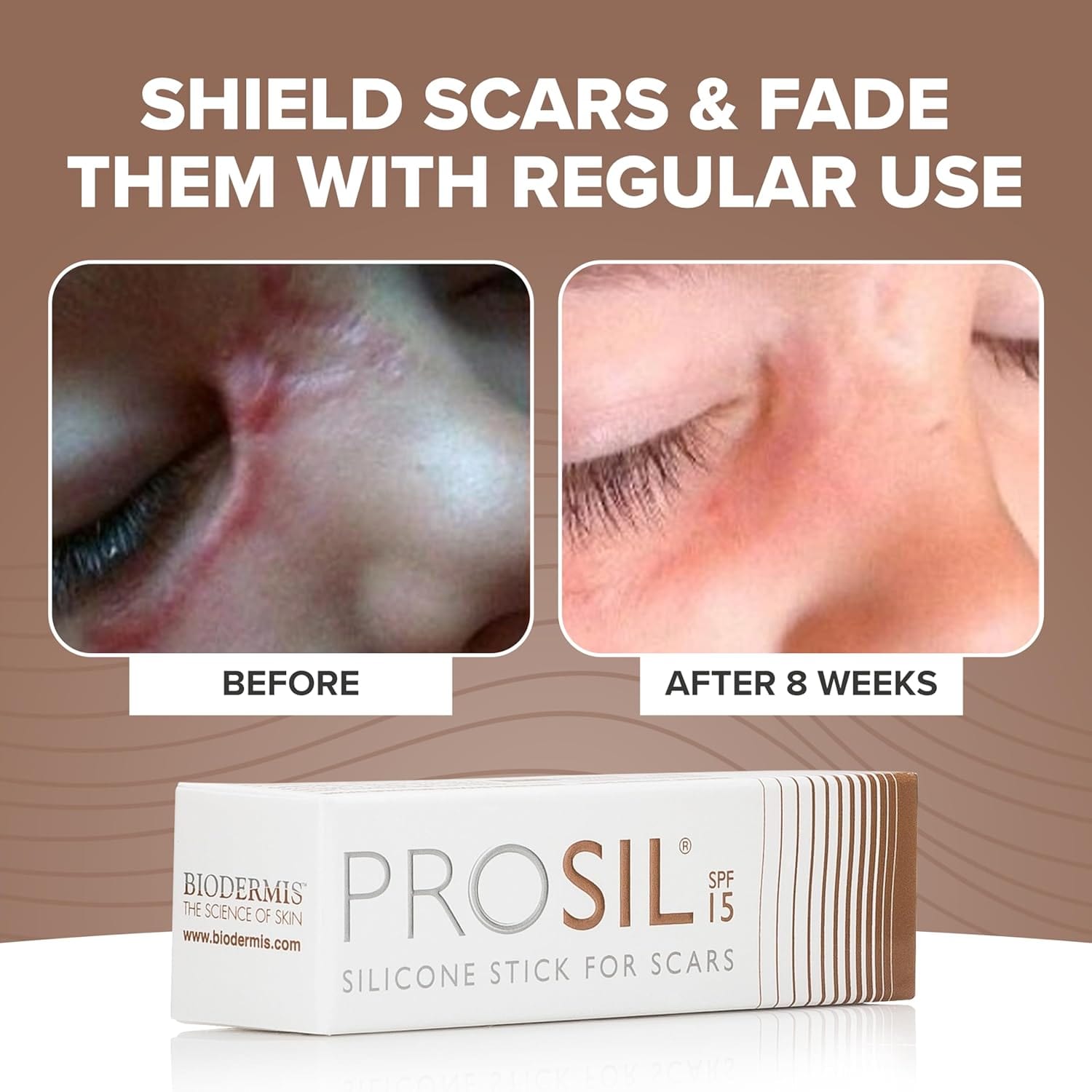 PROSIL Silicone Scar Stick SPF 15