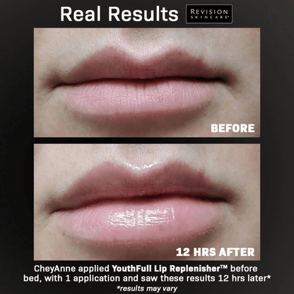 Revision Skincare YouthFull Lip Replenisher