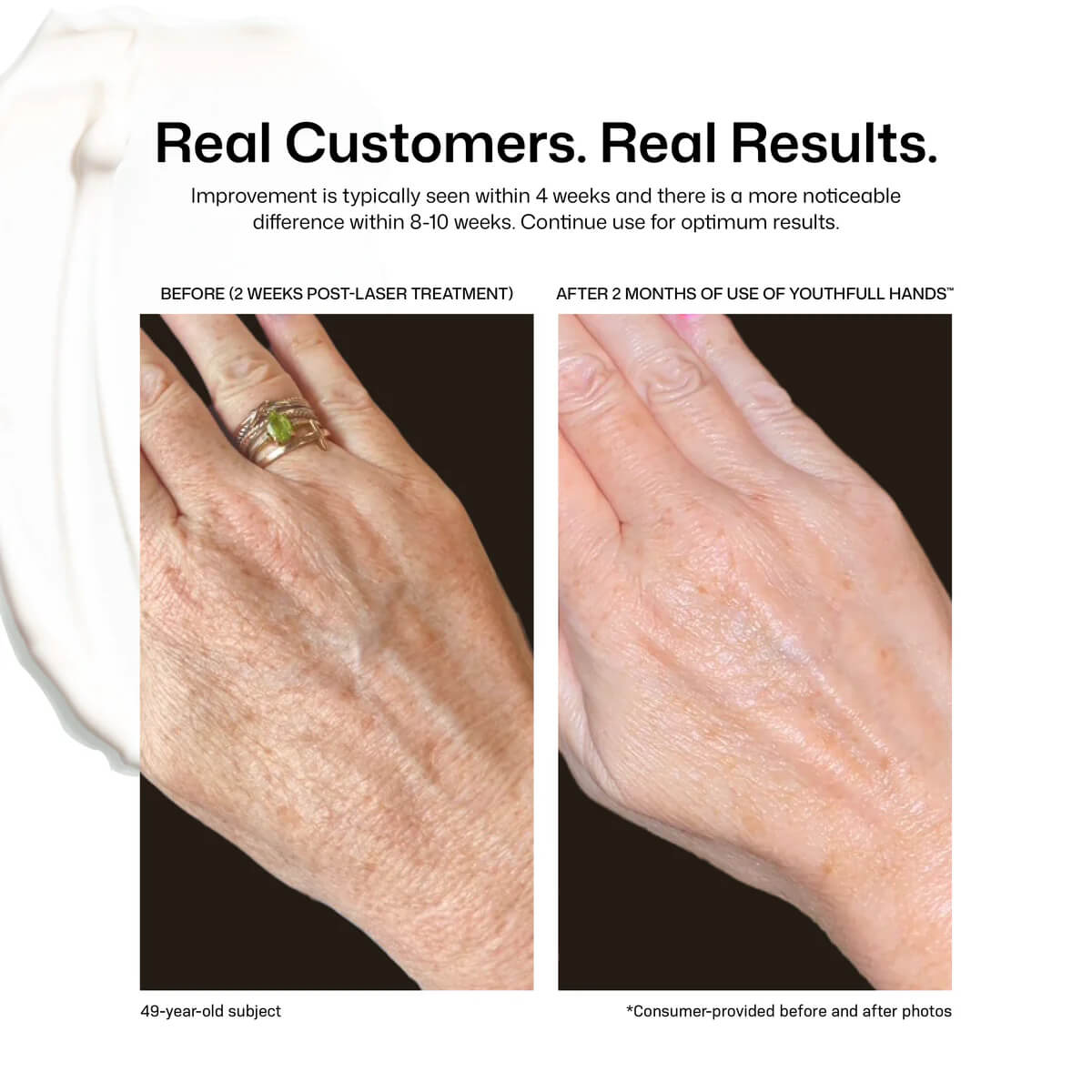 Revision Skincare YouthFull Hands