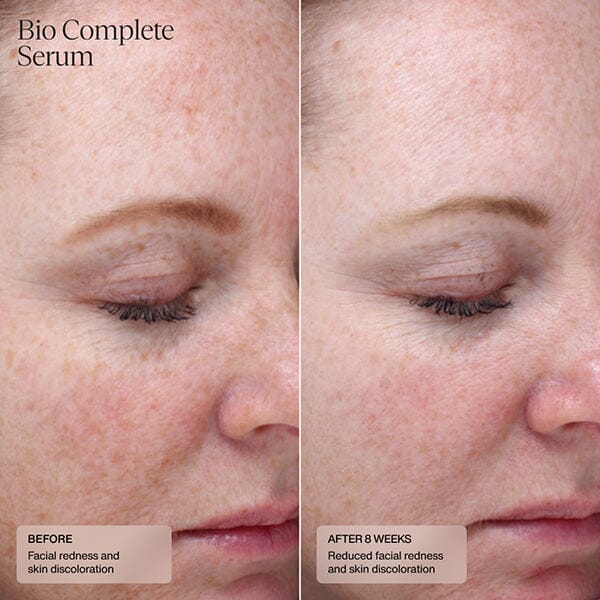 Senté Bio Complete Serum