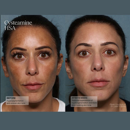 Senté Pigment & Tone Correcting Mask