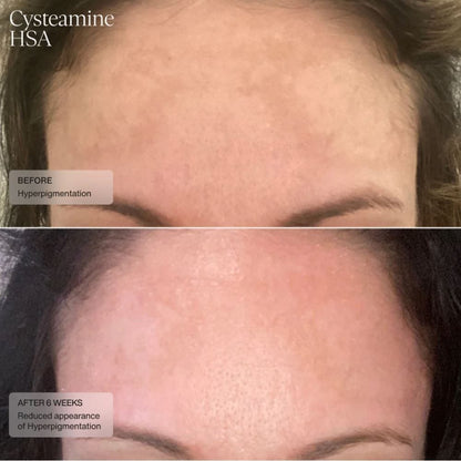 Senté Pigment & Tone Correcting Mask