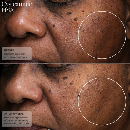 Senté Pigment & Tone Correcting Mask
